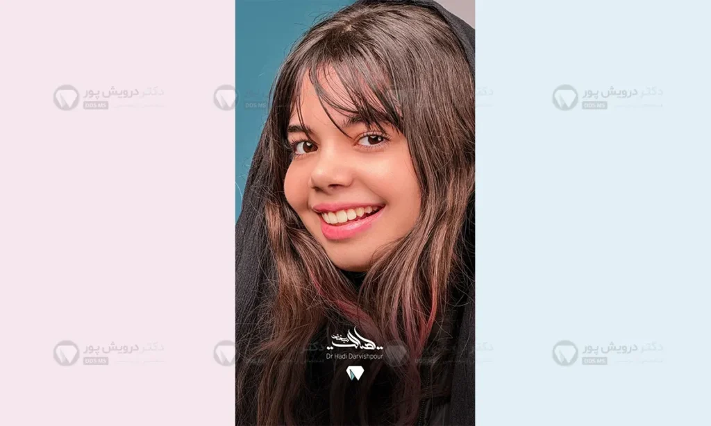 ارتودنسی نوجوانان