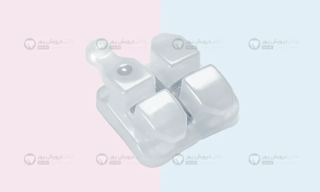 براکت ارتودنسی سرامیکی