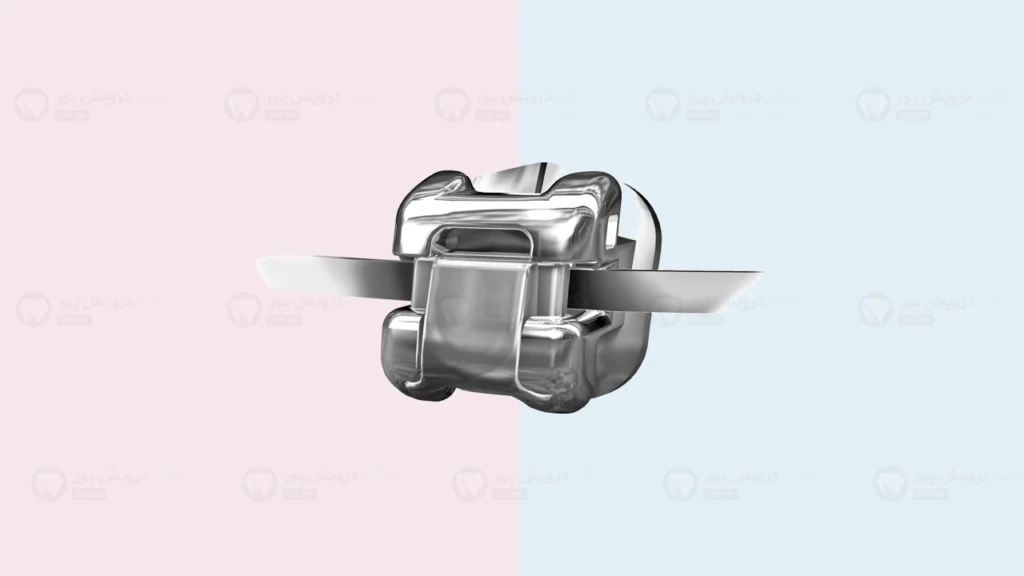 براکت ارتودنسی ثابت دیمون