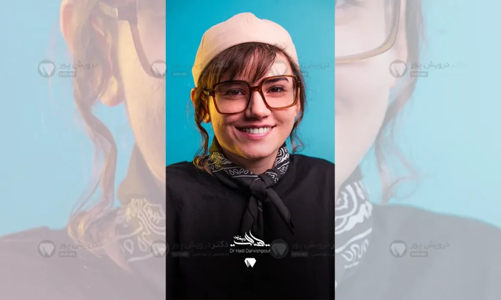 بعد از درمان ارتودنسی نوجوانان