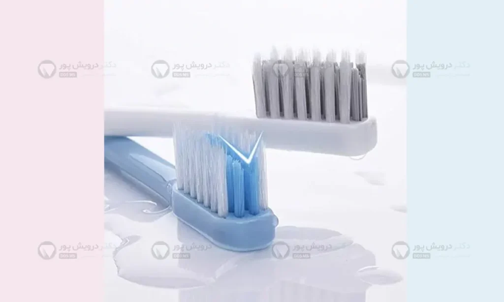 مسواک ارتودنسی با برس V شکل