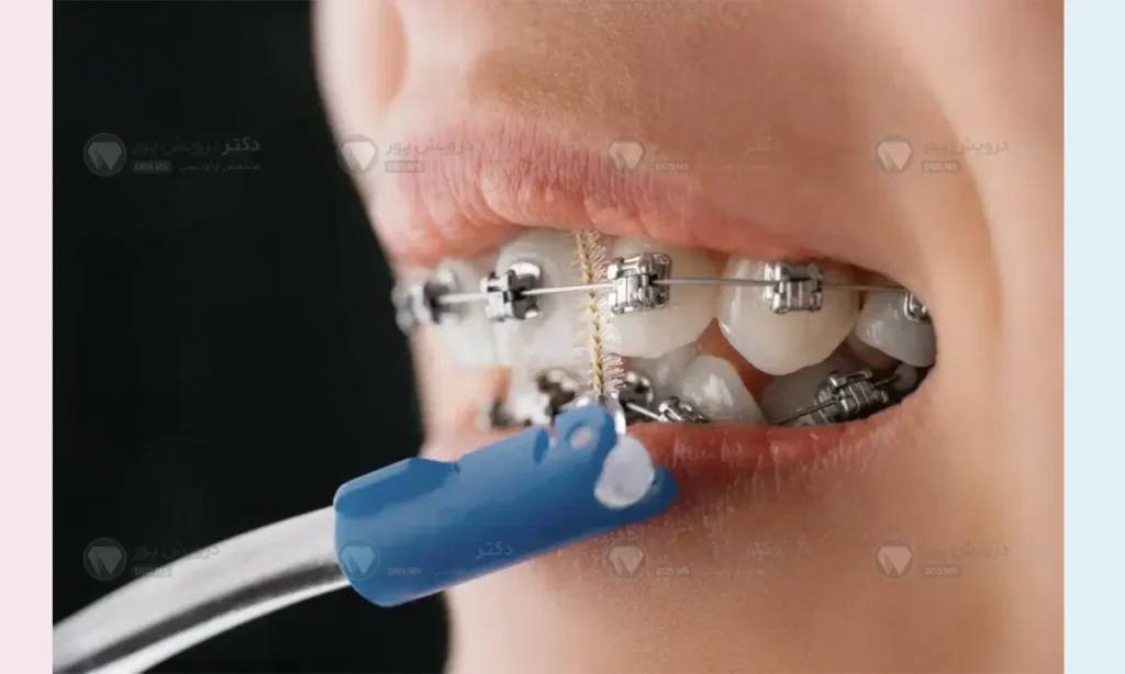 مسواک بین دندانی