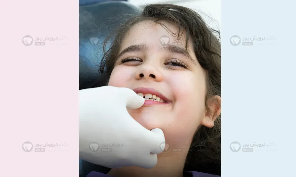 مشکلات ارتودنسی کودکان