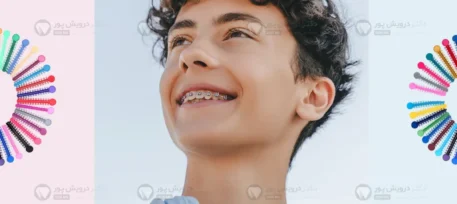 ارتودنسی رنگی شاخص