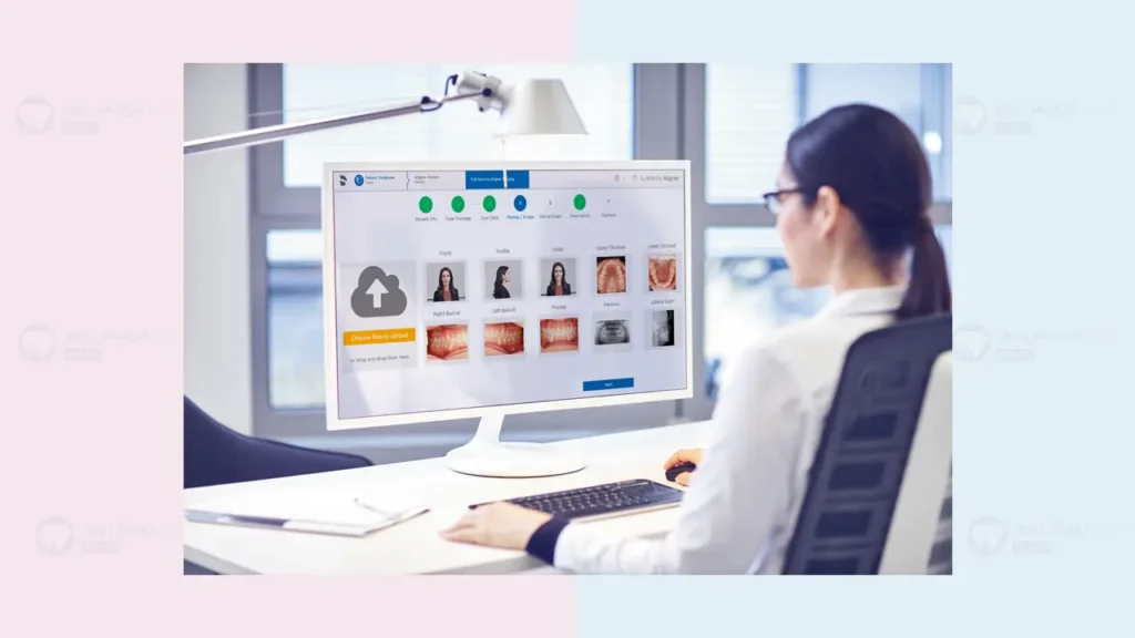 مکانیزم های ارتودنسی دیجیتال