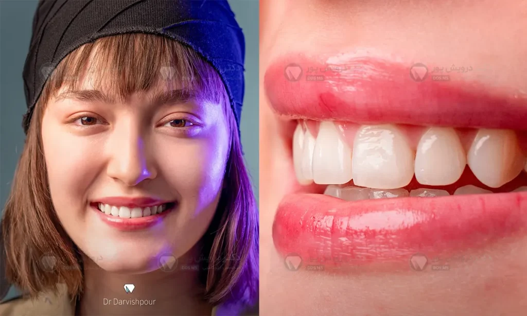 ارتودنسی معمولی