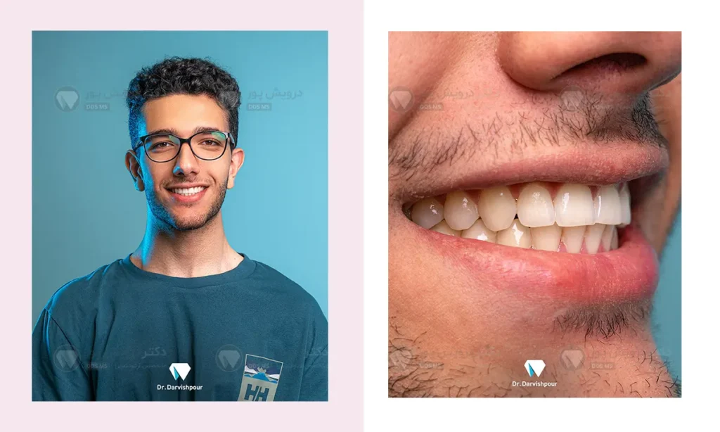 بعد از درمان ارتودنسی