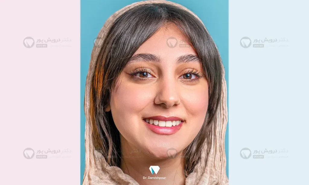 استفاده مرتب از ریتینرهای ارتودنسی