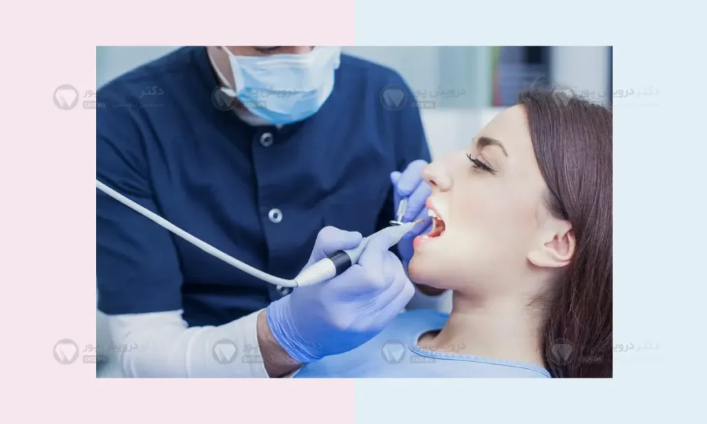 جرمگیری دندان در طول ارتودنسی