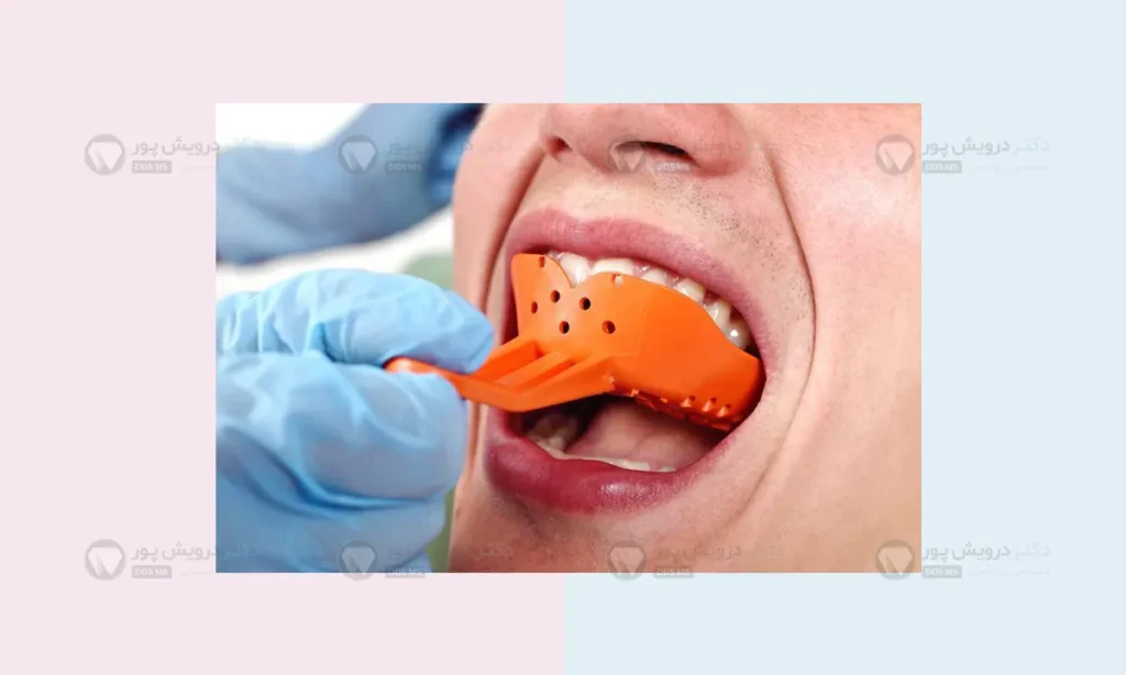 قالب گیری سنتی