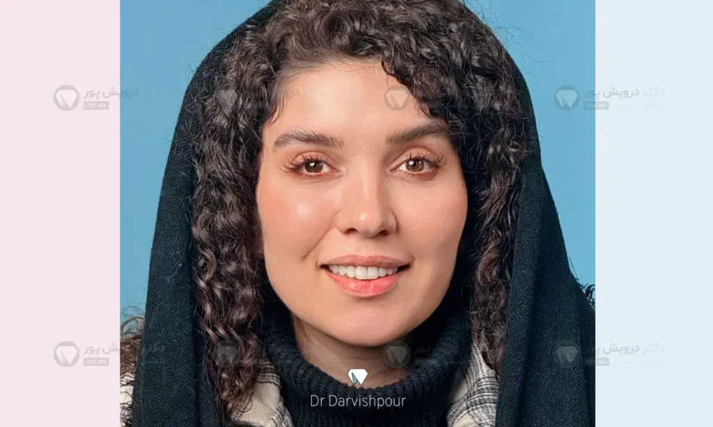 نتایج درمان ارتودنسی