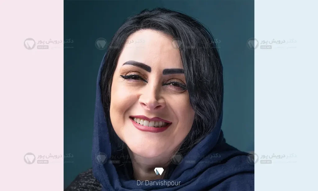 مدت زمان ارتودنسی بزرگسالان