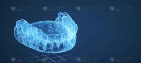 ارتودنسی دیجیتال شاخص