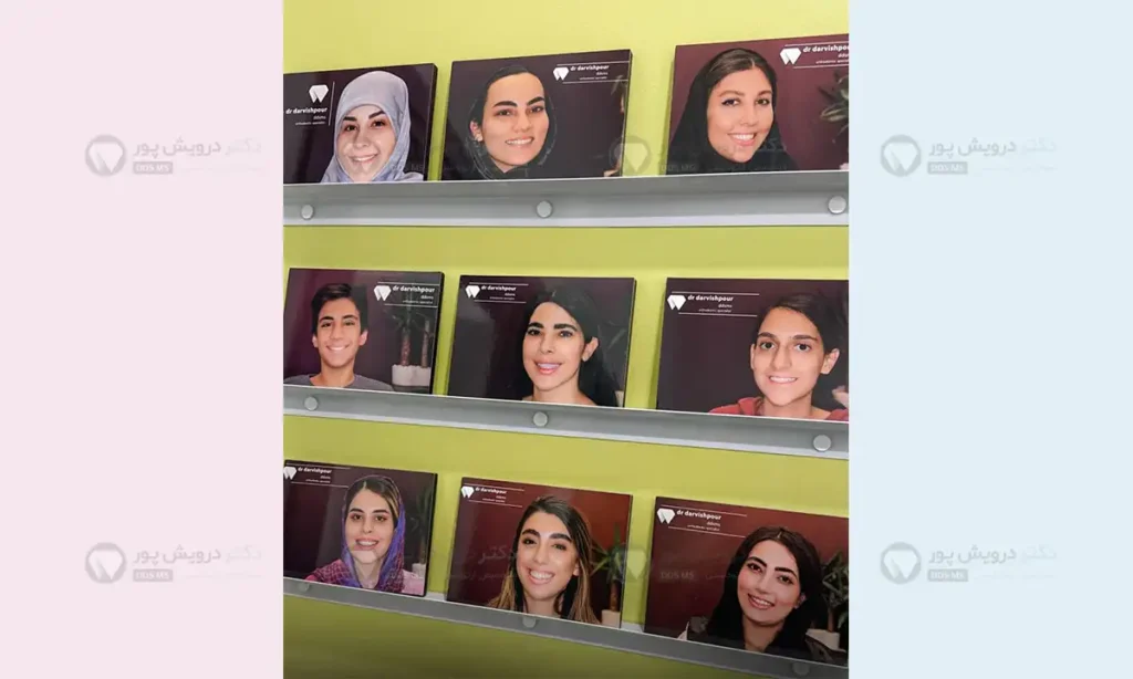 نتایج درمان ارتودنسی دندان