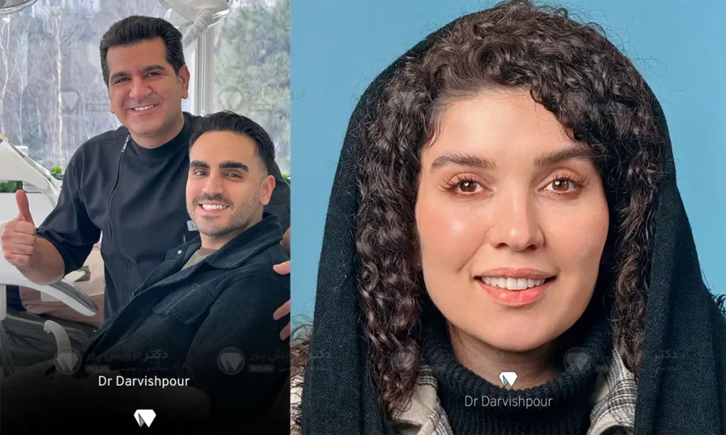 لبخند زدن بعد از درمان ارتودنسی دندان