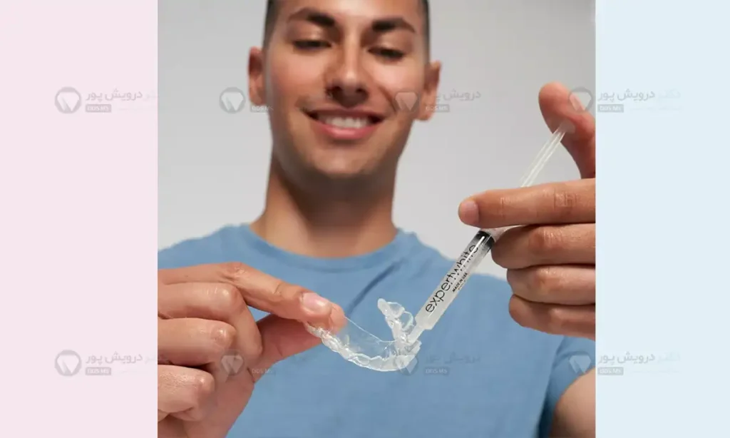 ریختن ژل سفید کننده در الاینرها