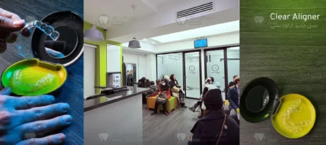 بهترین مرکز ارتودنسی نامرئی شاخص
