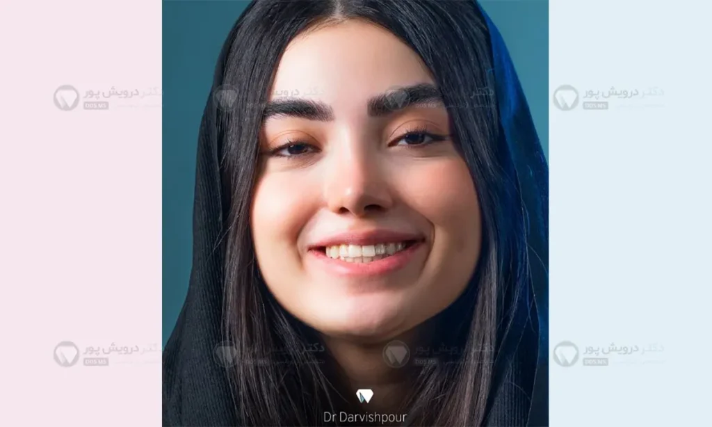 لبخند زدن