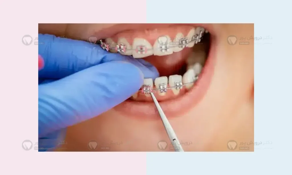 فلوشیپ ارتودنسی جراحی