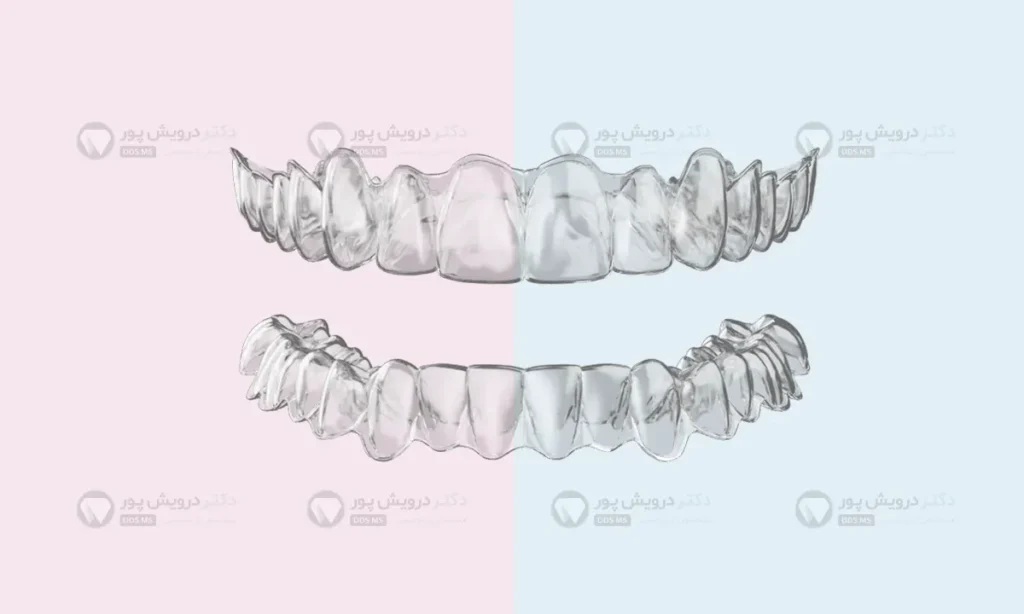 الاینرهای شفاف