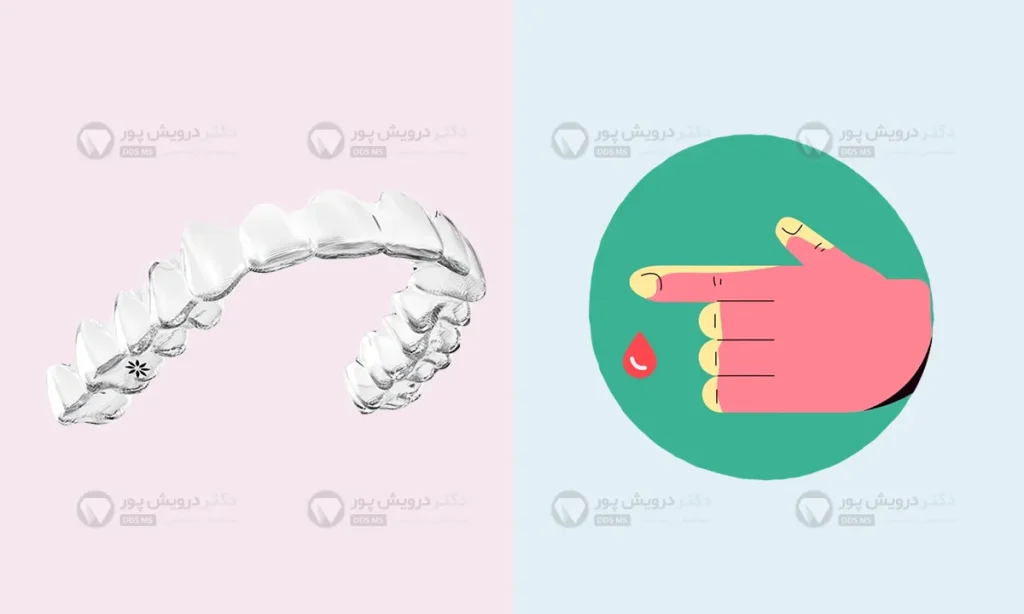 الاینر شفاف برای دیابتی ها