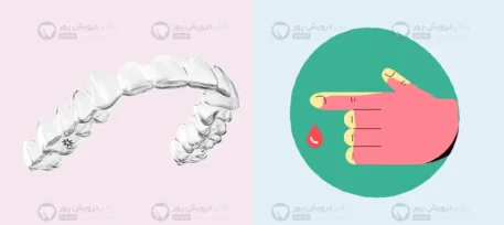 الاینر شفاف برای دیابتی ها