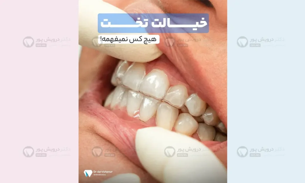 شکل ارتودنسی نامرئی وقتی در دهان بیمار است