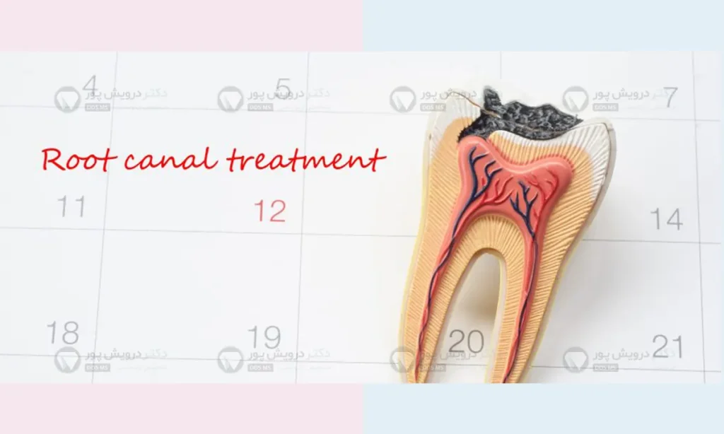 عصب کشی قبل از شروع ارتودنسی دندان