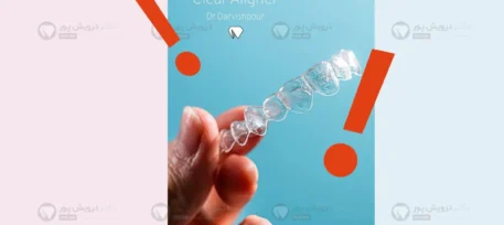 جلوگیری از شکستن الاینر شفاف شاخص