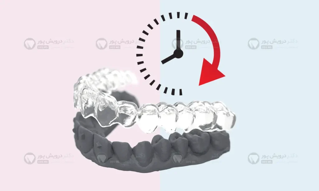 مدت زمان ارتودنسی نامرئی شاخص