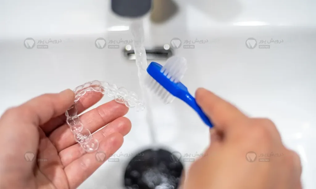 مراقبت از الاینرهای شفاف ارتودنسی