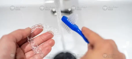 مراقبت از الاینرهای شفاف ارتودنسی