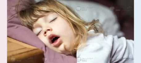 بهبود تنفس دهانی با ارتودنسی شاص