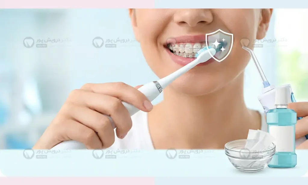 جلوگیری از زرد شدن دندان در طول ارتودنسی شاخص