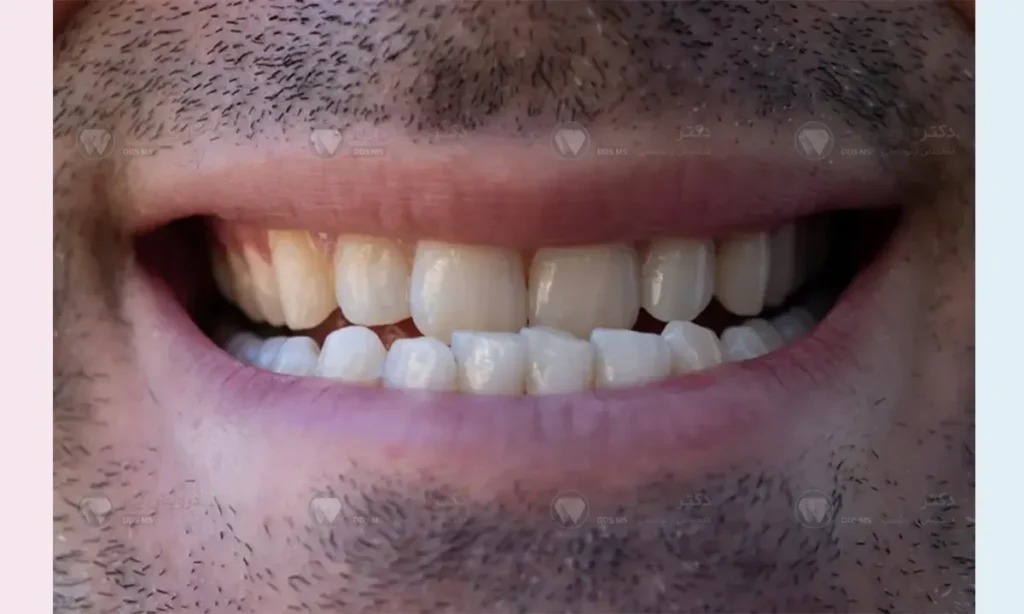 عکس آندربایت واقعی