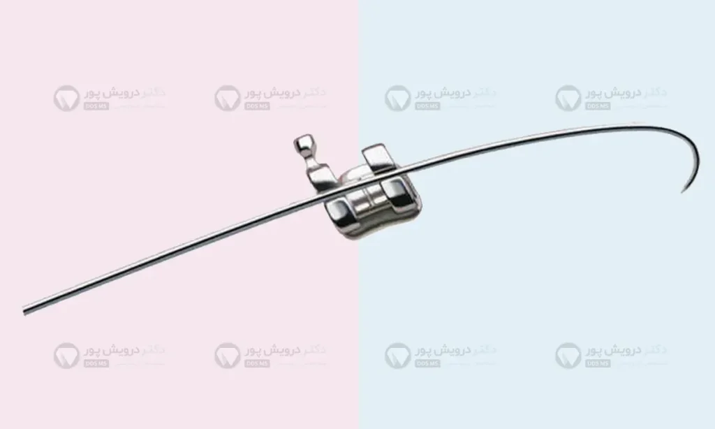 سیم و براکت ارتودنسی