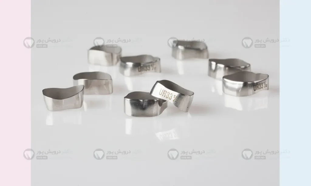 بند ارتودنسی شاخص