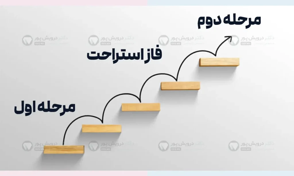 ارتودنسی دو مرحله ای شاخص