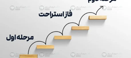 ارتودنسی دو مرحله ای شاخص