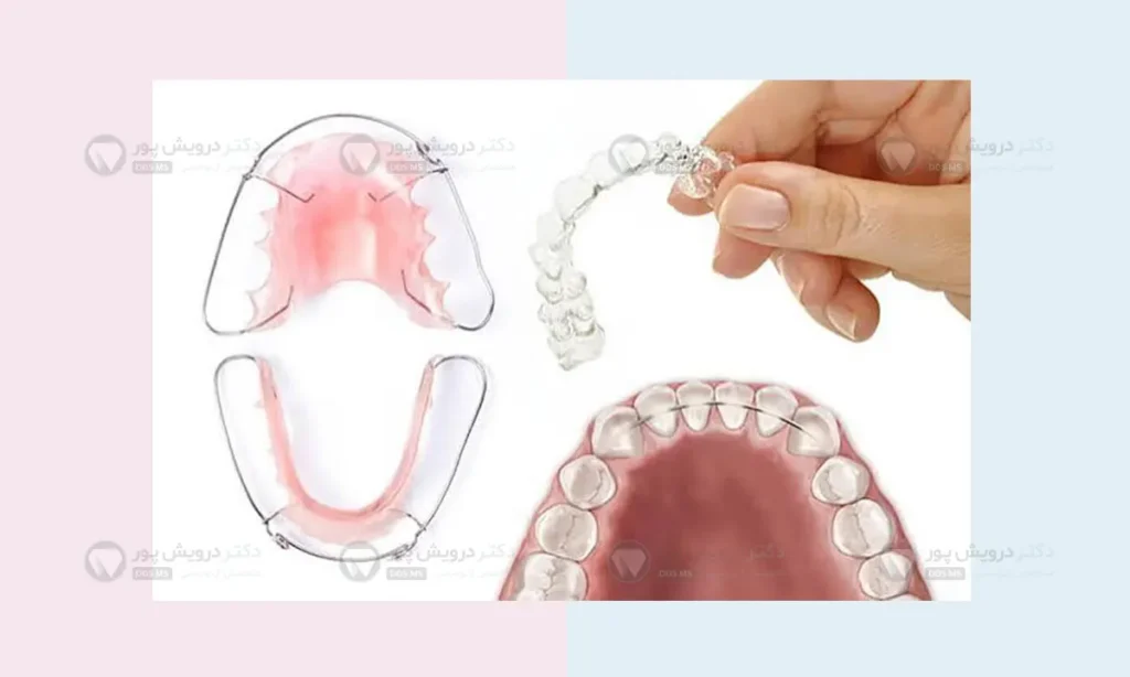 عکس انواع ریتینر ارتودنسی