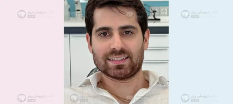 عادت به ارتودنسی نامرئی شاخص
