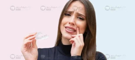 ریسک ارتودنسی نامرئی توسط پزشک غیرمتخصص شاخص