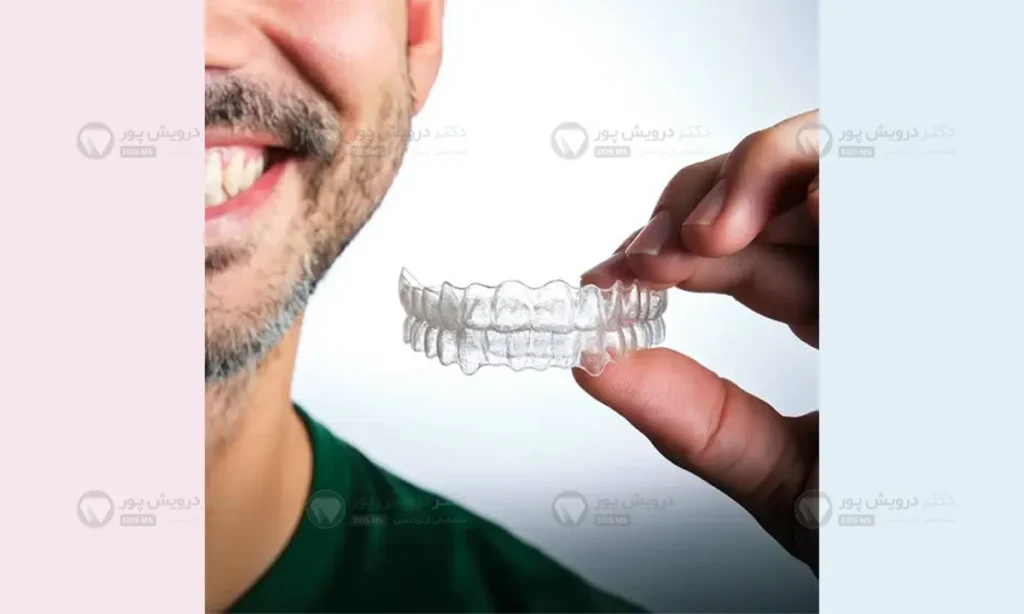 الاینر شفاف