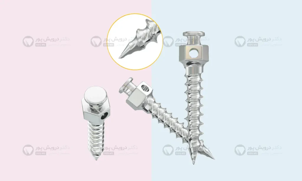 مینی اسکرو ارتودنسی شاخص